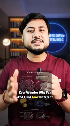Why does Fat and Fluid look different in MRI?? #science #medical #radiology #shorts #ytshorts #mri