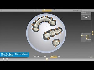 inLab CAM 18: How to Sprue Restorations