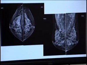 63K views · 415 reactions | Diagnóstico por imagem: como funciona? (Raios X, Tomografia, Ressonância Magnética, Ultrassom) | Visão X | Facebook