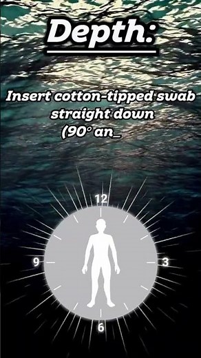 Wound Assessment - Measurements - Length, Width, Depth : Wound Care SHORT | ‪@LevelUpRN‬