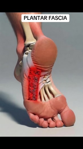 PLANTAR FASCIA - That first step pain has a name—and a reason. Morning step causes fascia micro-tears to light up. #fyp #viral #3danatomy #medicalanimation #humanbody