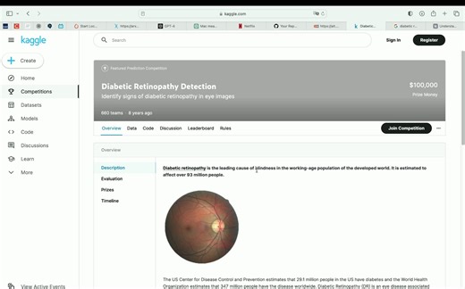 Diabetic Retinopathy Detection based on deep learning 深度学习实验笔记1-视网膜病变检测