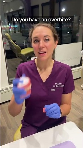 🦷Do you have an overbite?