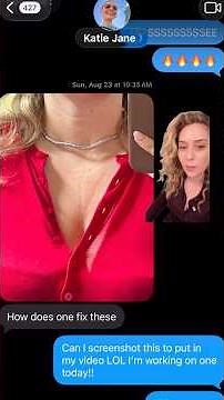 Dermatologist Gets Fat Transfer for Chest Wrinkles (Sleep Lines)