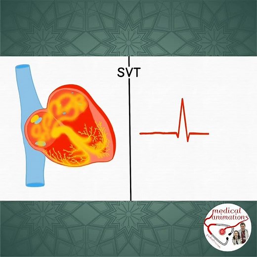 NORMAL CARDIAC RHYTHM & SVT