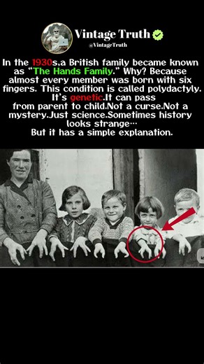 The Family Born With Extra Fingers 1930s #history #rememberinghistory