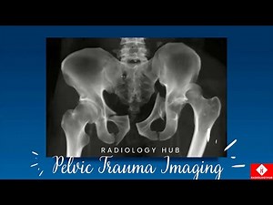 Pelvic Trauma Imaging - Mechanism of Injury - Everything You Need To Know