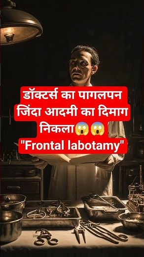 🧠 “जब इलाज बना सज़ा | Frontal Lobotomy Explained”| ferocious science| #facts