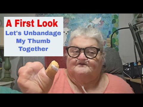 A First Look * Amputated Thumb * Chat * Zeek Has New $5 Items