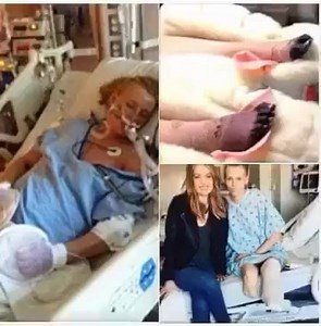 "Woman loses her legs after using a common household item – Now she’s warning others" | Ruby Taylor