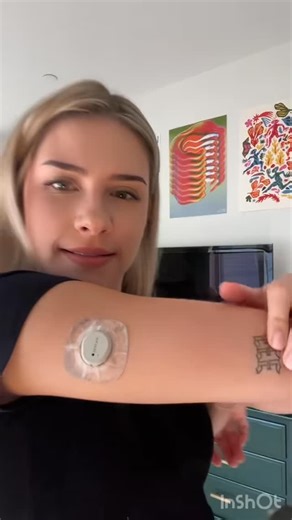 Type One Style | Does your Dexcom usually end up looking this dirty? 😖 From sports, fuzzy jumpers, gym sweat, or even fake tan — it happens! ✨ Keep your... | Instagram