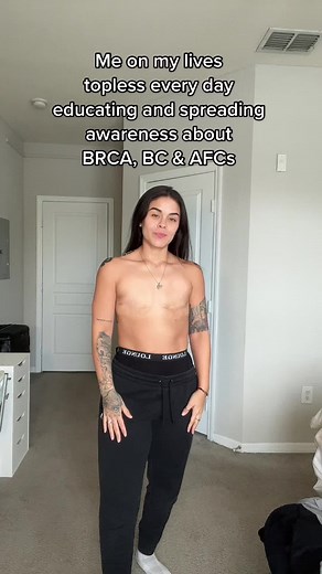 Because I am a woman with NO nipples or breasts, it’s perfectly legal to not wear a shirt on social media and out in public 🫶🏽 Just here to spread awareness and educate 🤓 #fyp #brca1 #brca2 #doublemastectomy #mastectomy #aestheticflatclosure #afc #brca #bodypositivity