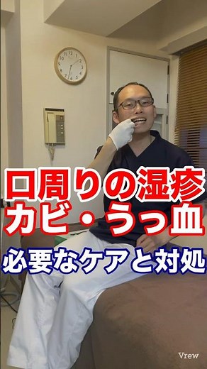 口周りの湿疹はカビの影響を疑う#口角炎#湿疹#カンジダ