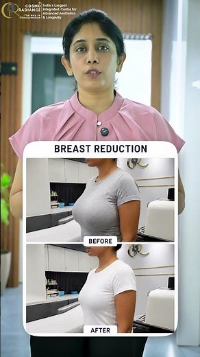 Breast Reduction Surgery Explained | Relief from Heavy Breasts & Back Pain | Cosmo Radiance
