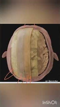 1. “Step inside the world of neurosurgery – Brain excision explained 🧠🔪”