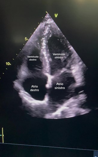 Camere cardiache all’ecocardiogramma 🫀 #doc #doctor #medicina #medstudent #cardiologia