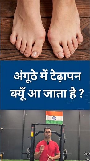 Causes of Bunion / Hallux Valgus