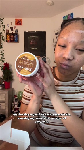 At least my edges are cute ig (pt.3)….(edge tutorial) #hair #edges #fyp #viral #acne @Hairplexx Beauty