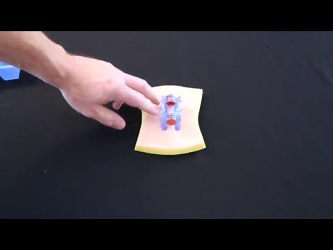 iTClamp Application Video