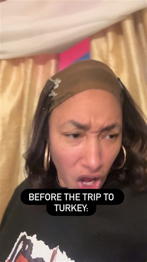 Turkey said, “You left my homeboy out? I got you!” & became the Dr Miami for men. We love equality. #hairreplacementsystem #turkey #gigileflair