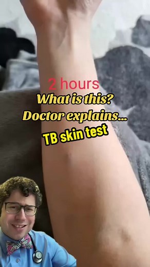 @awname99 What is a TB skin test? How are TB skin tests interpreted? #tb #skintest #tiktokdoc #learnontiktok