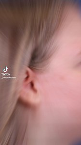 Neck define before and after at Omaha Face! This lovely patient is 3 months out from a minimally invasive neck lift. #necklift #plasticsurgery #plasticsurgeon #omaha #mininecklift #omahaface #facetite #lipo #neckliftbeforeandafter #omahanebraska #plasticsurgeryjourney #surgery #trending #beforeandafter | Omaha Face