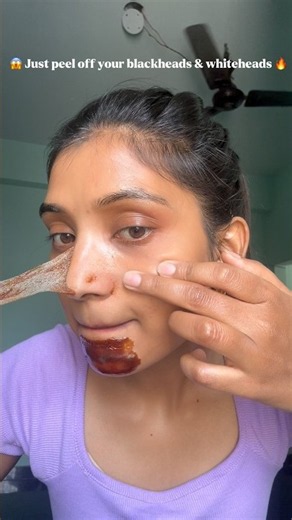 Diy nose strip for blackhead & whitehead😱#skincare #viral #ytshorts #youtubeshorts