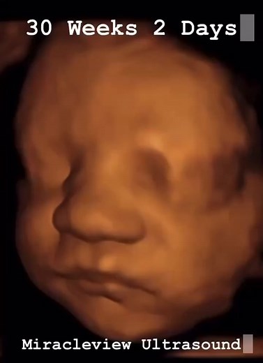 Miracle View Ultrasound on TikTok