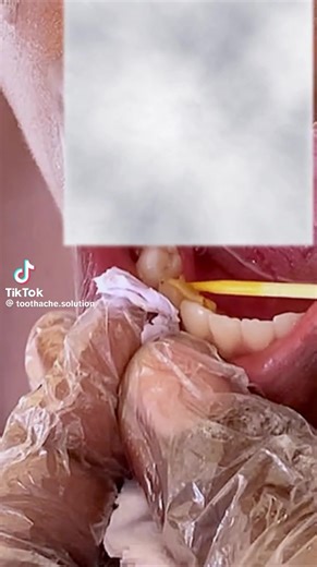 Toothache solution (@toothachesolution)’s videos with original sound - Toothache solution