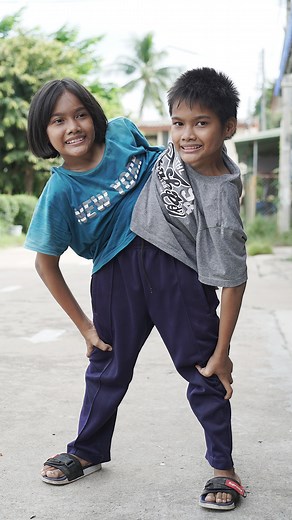 Conjoined twins Pin and Pan are joined at the hip and share one leg each | Born Different