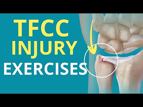 5 Exercises for a TFCC (Wrist) Injury