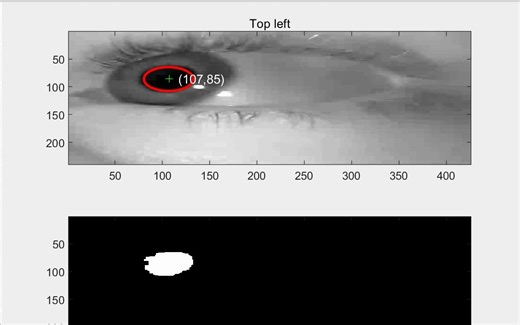 使用图像处理跟踪瞳孔（Matlab代码实现）