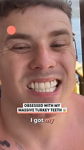 1.7M views · 3.6K reactions | His giant teeth look so cool and expensive  | Happiest | Facebook