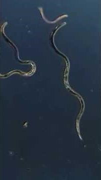 Parasite VS White Blood Cell 🔬 #microscope #science #microscopic