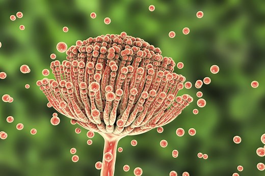 Aspergillosis: A Growing Global Crisis