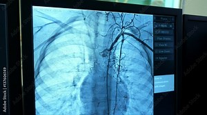 Process of cardio surgery is displaying on monitor in a control room