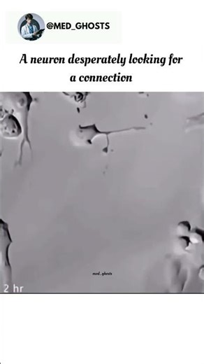 A neuron desperately looking for a connection #brain