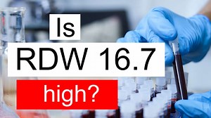 Treatment and symptoms of RDW 16.7 % | Diet for high Red cell distribution width level 16.7 %