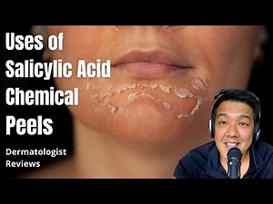 Salicylic Acid Peels | Indications
