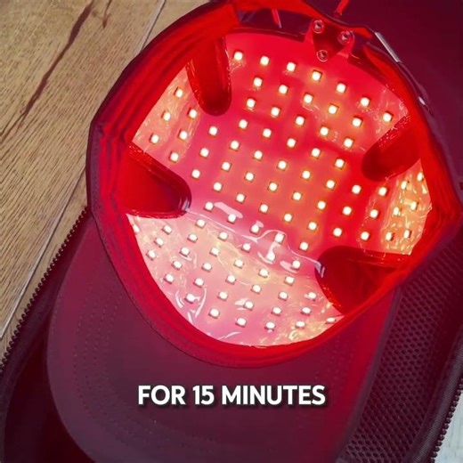90 Day Hair Growth Results Using Red Light Therapy