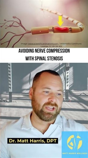 Avoiding Nerve Compression with Spinal Stenosis #backpain #painrehabb #spinalstenosis