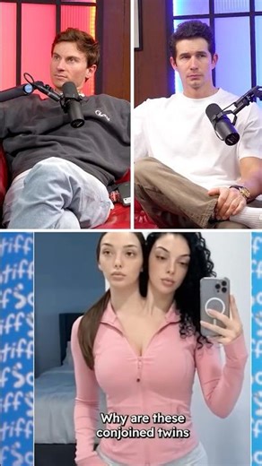 Conjoined twins deny they are fake‼️