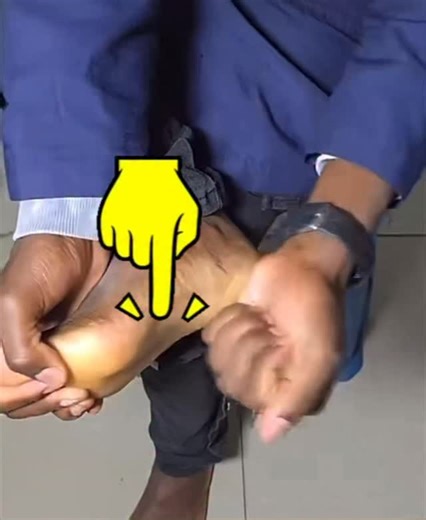 Pagod ang paa? Mahina ang blood flow? Itong Japan EMS Foot Massage Pad ay nakakatulong sa circulation, relaxation, at foot stimulation — perfect lalo na sa stroke survivors na madalas naninigas o nanginginig ang paa. Gamitin 10–15 minutes a day para maramdaman ang gaan, init, at improved muscle response. Comment “EMS” kung gusto mo ng basic foot activation routine para sa stroke recovery. #Pagbangon #StrokeRecoveryPH #EMSMassage #FootTherapy #MuscleActivation #HemiplegiaRecovery #BloodCirculatio