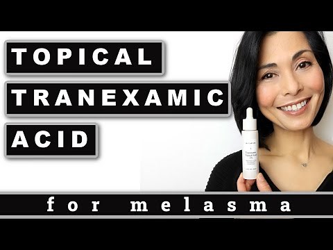 Topical Tranexamic Acid For Treating Melasma