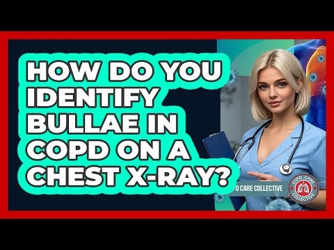 How Do You Identify Bullae In COPD On A Chest X-ray? - COPD Care Collective