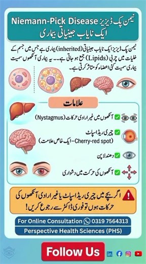 Niemann-Pick Disease | Rare Genetic Disorder | #eyehealth #optometry