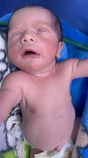 #babyfirstminutes #love #cutebaby calm baby with good Moro reflex 💓👶💓