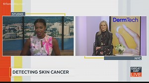 Detecting skin cancer through a smart sticker