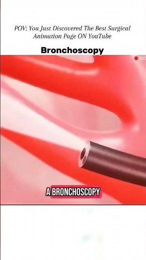 Bronchoscopy