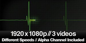 Animated ECG Heartbeat Line Monitor with Flatline Effect